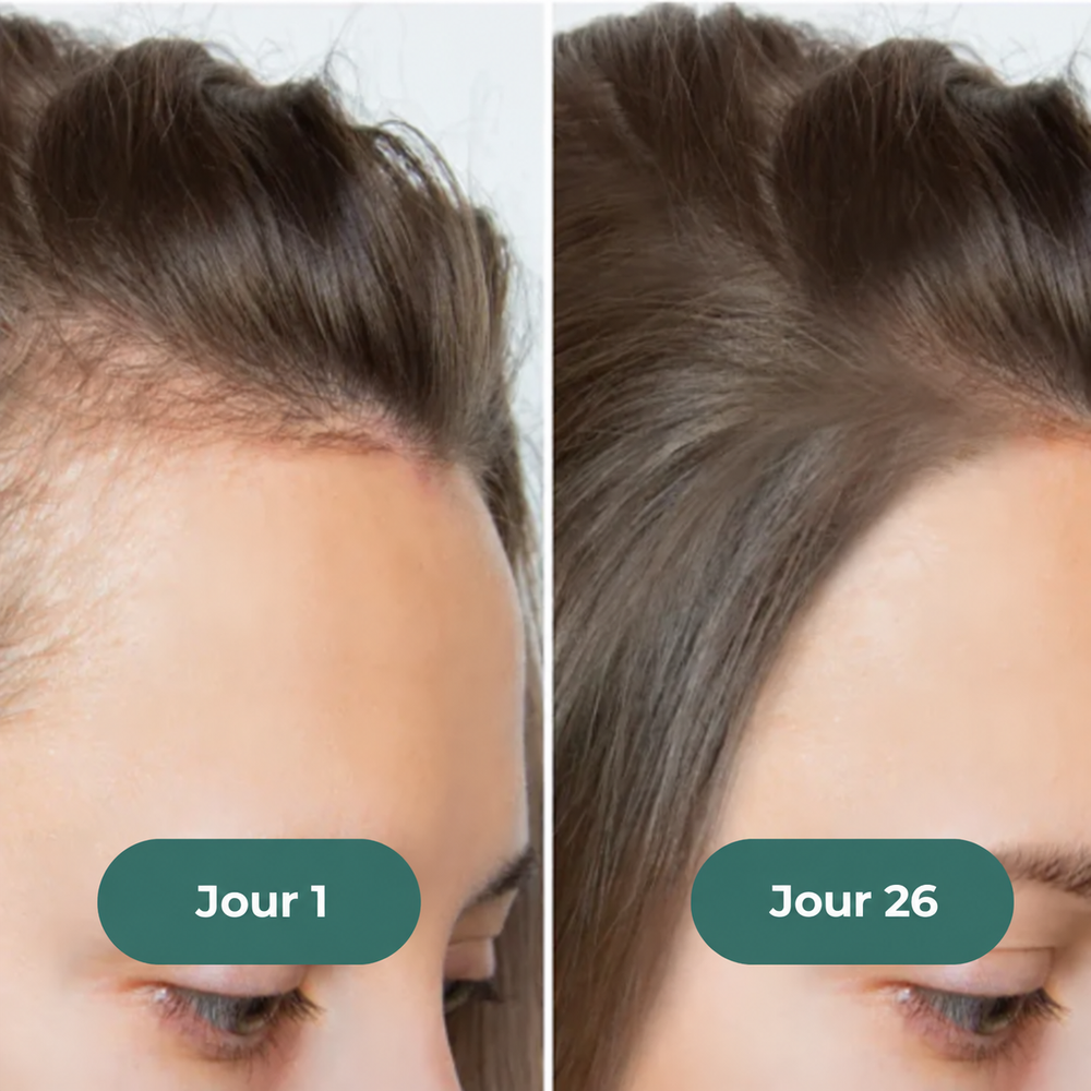 Mes cheveux ont complètement changé